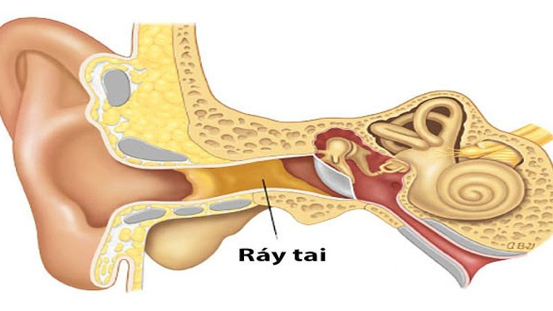 Ráy tai đang được tiết ra