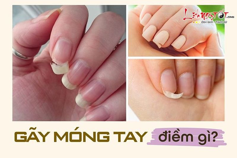 Bảo Vệ Móng Tay: Lời Khuyên Từ Chuyên Gia 5